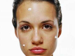 Effektiv gel til acne og acne